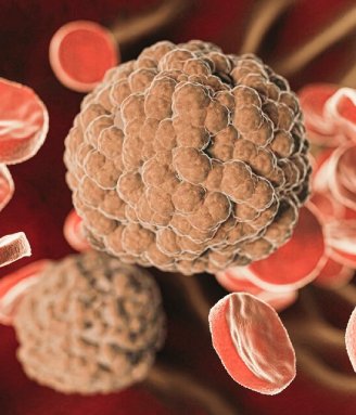 Who Can Benefit from CAR T-Cell Therapy?